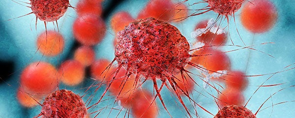 Image of cancer cells