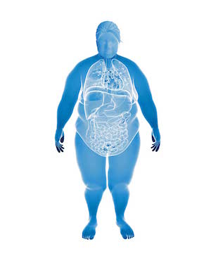 Graphic of an obese individual with transparency showing the inner organs