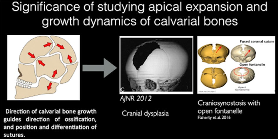 Significance of studying apical expansion and growth dynamics of cavarial bones