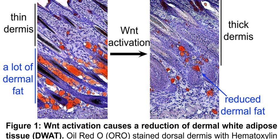 Figure 1: Wnt activation causes a reduction of dermal white adipose tissue (DWAT)