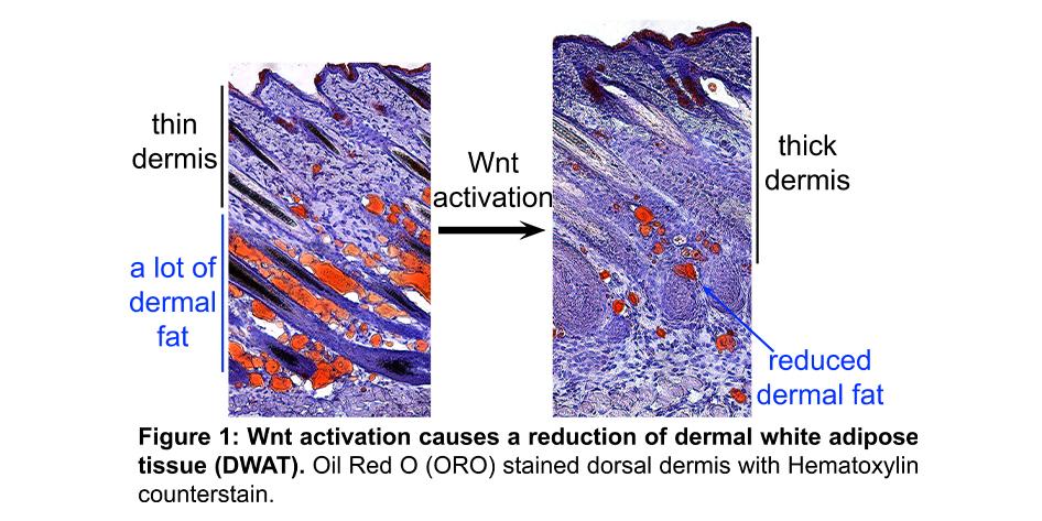 Figure 1: Wnt activation causes a reduction of dermal white adipose tissue (DWAT)