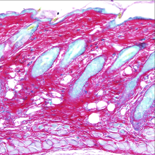 21d βcatistab dorsal dermis stained with Picrosirius Red, Alcian Blue, and Fast Green (RGB Trichrome).