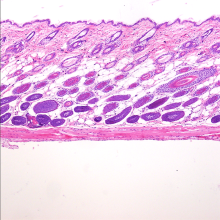 21d βcatistab dorsal dermis stained with Hematoxylin and Eosin (H&E).