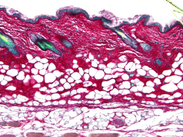 Close up image of skin cells