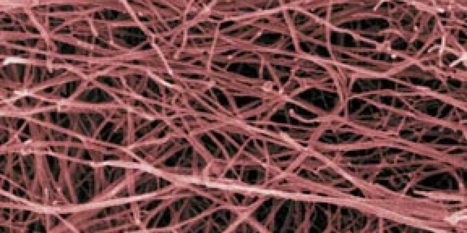 Microscope image depicting overlapping red strands