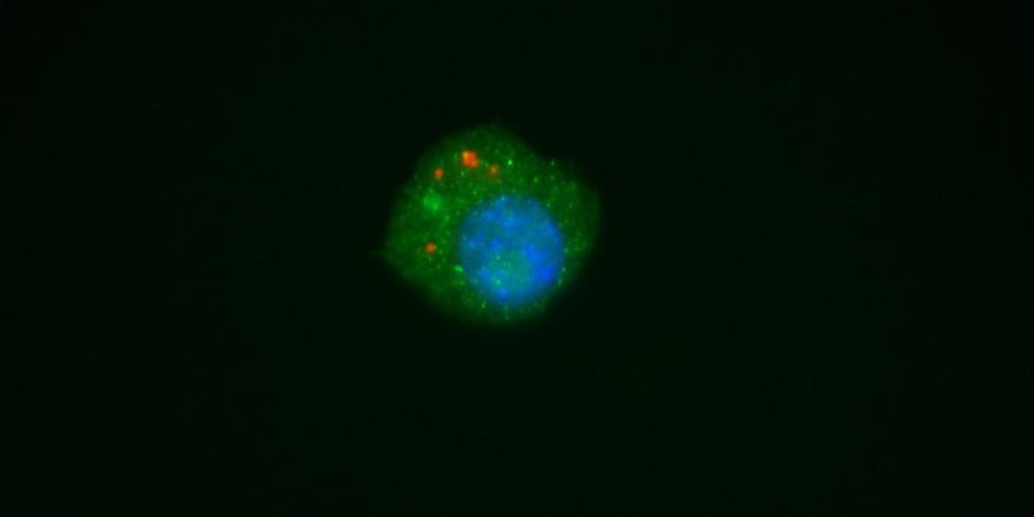 Microscope image of Single Primary microglia cell, with phagocytosed fluorescent nanoparticle