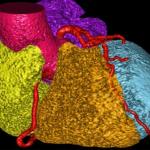 AI Cardiac segment imaging