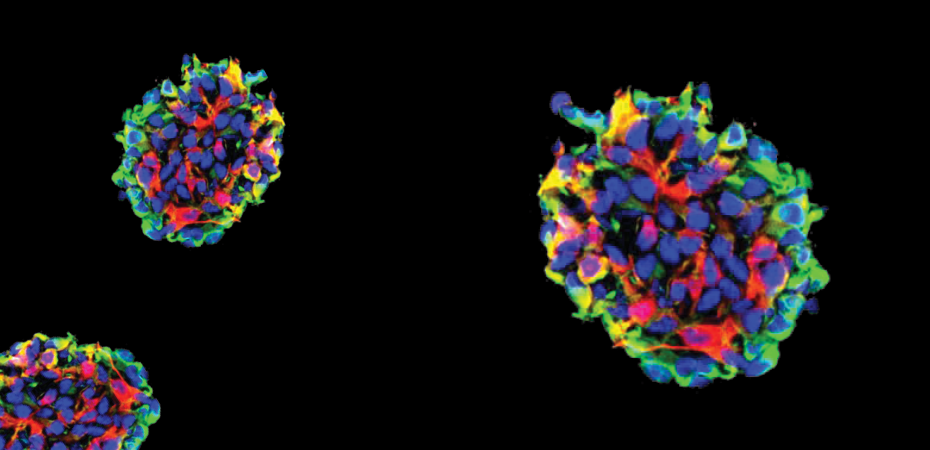 Glioma stem cells on a black background