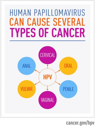HPV causes several types of cancer factoid article