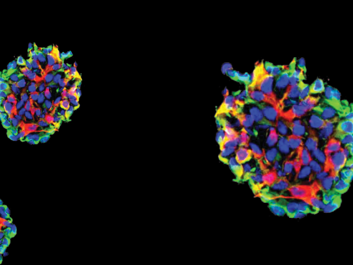 Glioma stem cells on a black background