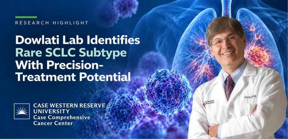 Afshin Dowlati, MD, pictured with an illustration of the lungs and cancer cells for research examining a rare small cell lung cancer subtype with potential precision-treatment opportunities.