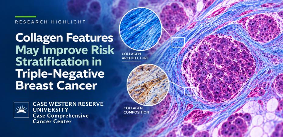 Research Highlight graphic showing breast cancer tissue with magnified views of collagen architecture and composition, illustrating research on improving risk stratification in triple-negative breast cancer.