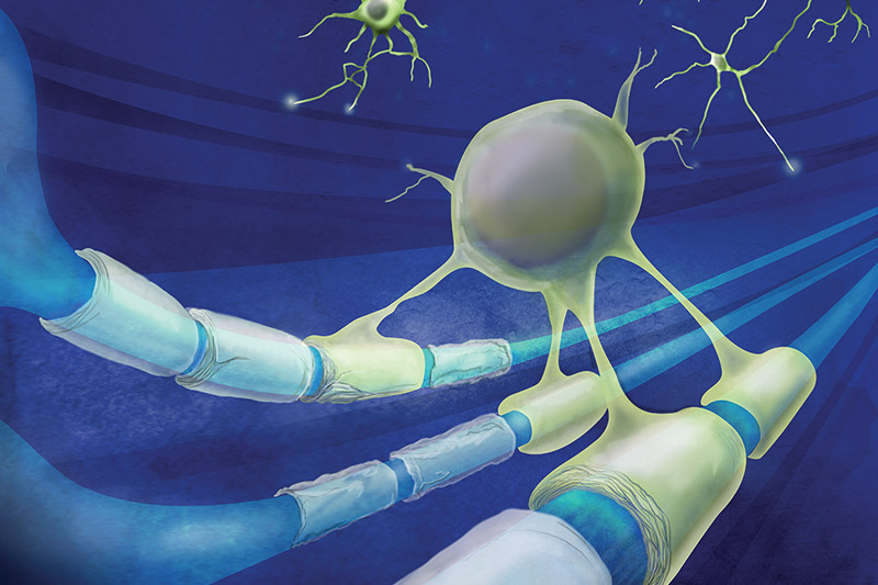 Illustration of MS cells