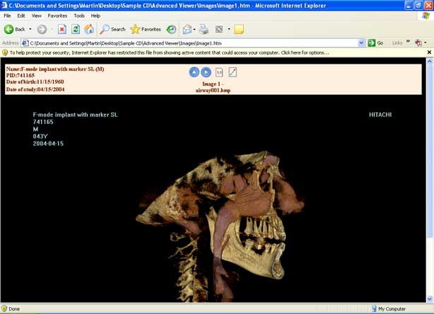 Screenshot of enhanced patient image
