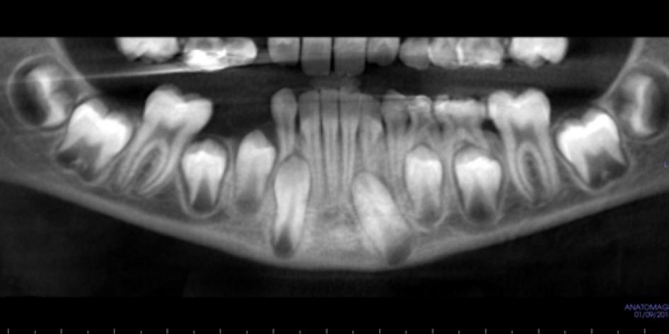 Dental x-ray 