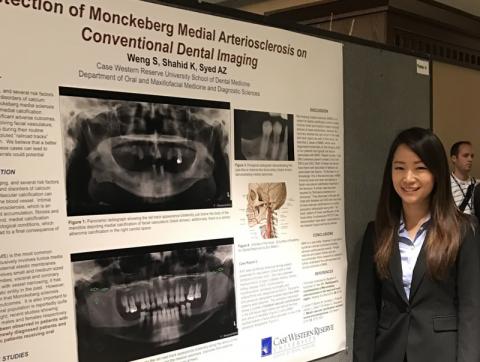 Stephanie Weng presenting at the annual AAOMR meeting