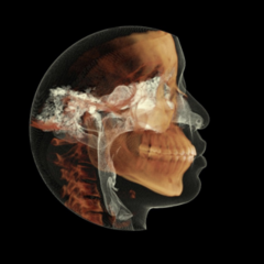 cbct1