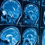Case Western Reserve researchers land $1.1M National Science Foundation grant to advance safer, faster and less expensive medical-imaging technology