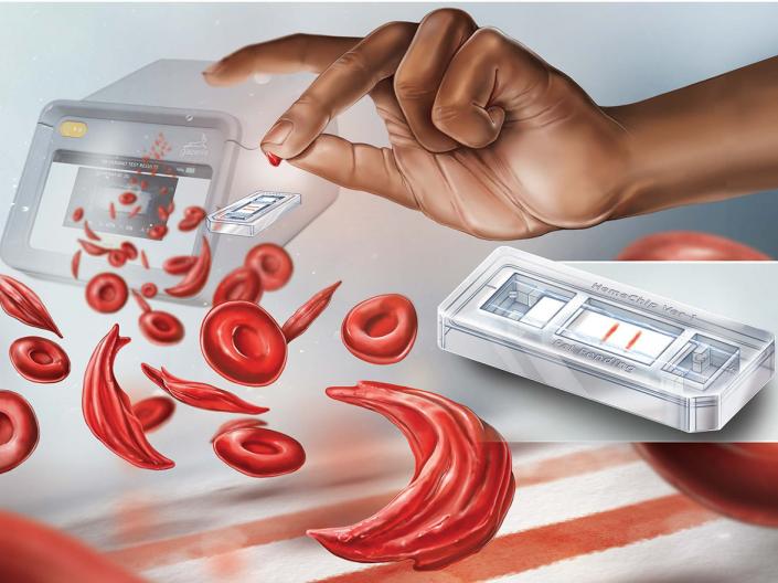 Illustration with cells and human hand showing paper-based microchip electrophoresis for point-of-care hemoglobin testing