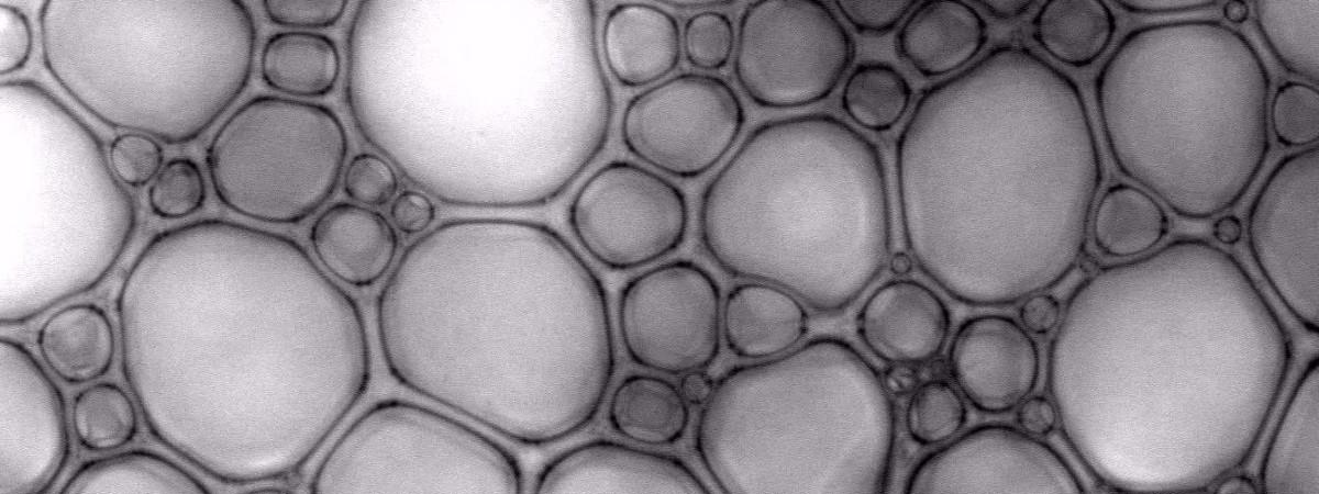 A close-up of foam under a microscope