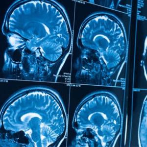 Medical imaging technology that shows images of brains