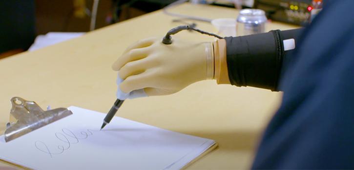 prosthetic hand writing on a paper