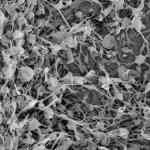 clot-stabilizing nanotechnology