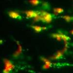 Image of fluorescent blood