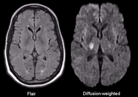 Mri t1 blood weighted The Usefulness