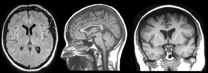 Axial - Sagittal - Coronal Views