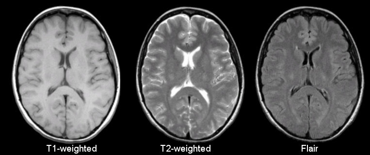 MRI Basics