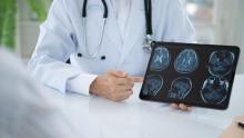 doc with brain scan