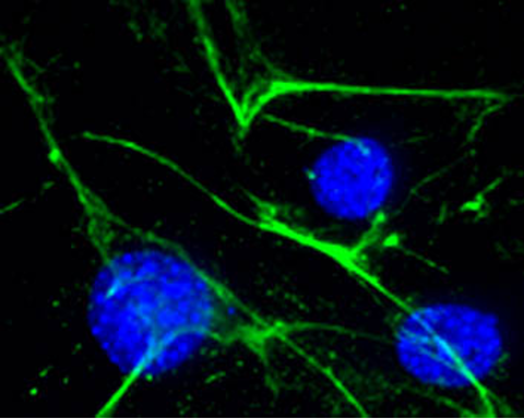 Photo of Cells from Mead Lab