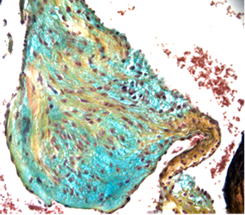 Photo of myx heart valve from Mead Lab