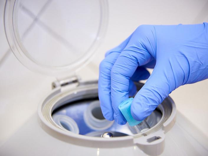 Dermatology researcher putting samples in a centrifuge 