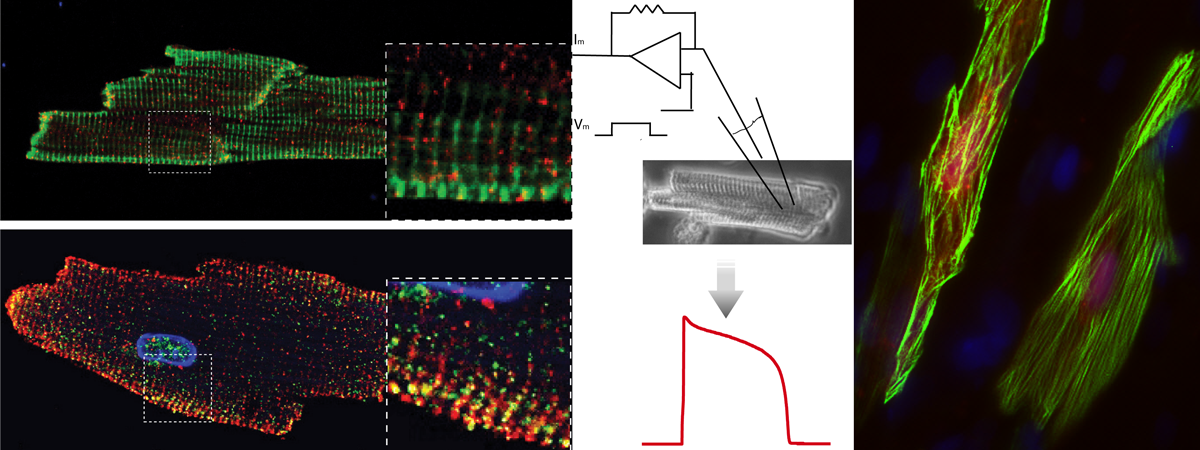 The composite banner includes a variety of immunofluorescence images of sarcomere markers and ion channels that are responsible to action potential in cardiomyocytes
