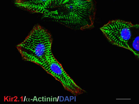 Immunostaining of α-actinin and a potassium channel, Kir2.1, in human iPSC-differentiated cardiomyocytes