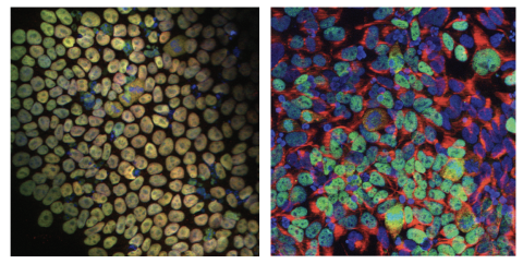 Immunofluorescence staining images of iPSCs and NPCs derived from the MEDS patient’s fibroblasts. 