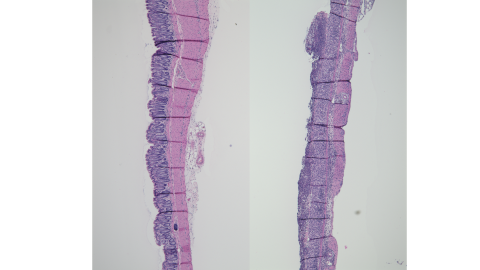 Formalin-fixed paraffin-embedded tissue sections prepared from the distal colons of naïve wild type mice (left) and DSS-exposed wild type mice (right) stained with hematoxylin and eosin show healthy colon crypts (left) versus complete loss of colon crypts (ulceration) induced by DSS-colitis (right).