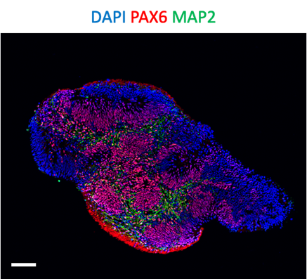 Fluorescence image of Cortical organoid