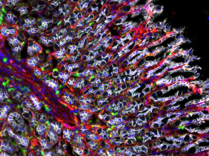 A close up image of a cell under a microscope