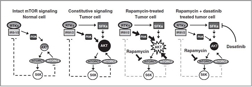 Illustration of the AKT/mTOR pathway under Dasatinib or Rapamycin treatments. 1) Intact mTOR signaling Normal cell 2) Constitutive signaling Tumor Cell 3) Rapamycin-treated Tumor cell 4) Rapamycin + dasatinib treated tumor cell