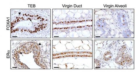 Microscope images of mouse mammary gland staining for FOXA1