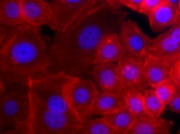 Microscope image of DAPI/Phalloidin stain of breast cancer cells.