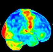 a PET scan result of a brain