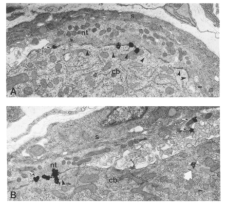 micrograph of Preganglionic nerve terminals (nt) and post-ganglionic cell bodies (cb) in the chick ciliary ganglion. The black autoradiographic grains from radioactive neuronal bungarotoxin are concentrated at synapses within the ganglion. two different images, one labelled A with small black arrows, and one labelled B with small black area in bottom left.