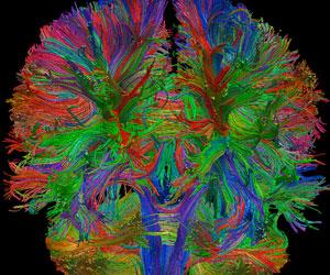 Colorful functional neurosurgical image