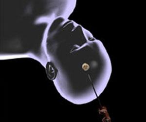Neuroblate scan