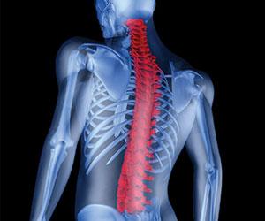 Red human spine digital x-ray image