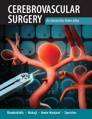 Cerebrovascular Surgery: An Interactive Video Atlas 